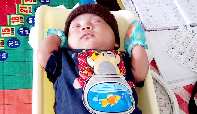 3,1 Persen Bayi di Pangandaran Alami Stunting