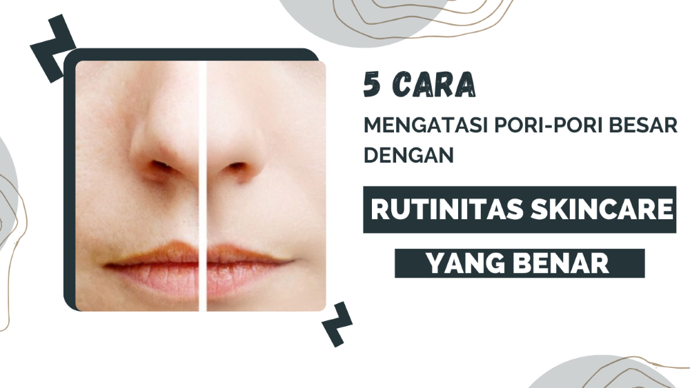 Tips Mengatasi Pori-Pori Besar Agar Kulit Tetap Sehat dan Cerah 