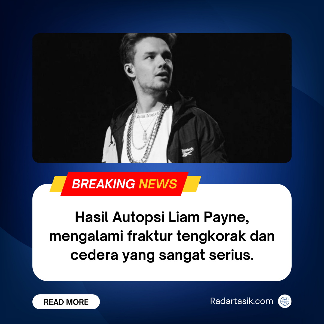 Hasil Autopsi Liam Payne dan Fakta di Balik Tragedi Kematian Eks Personel One Direction