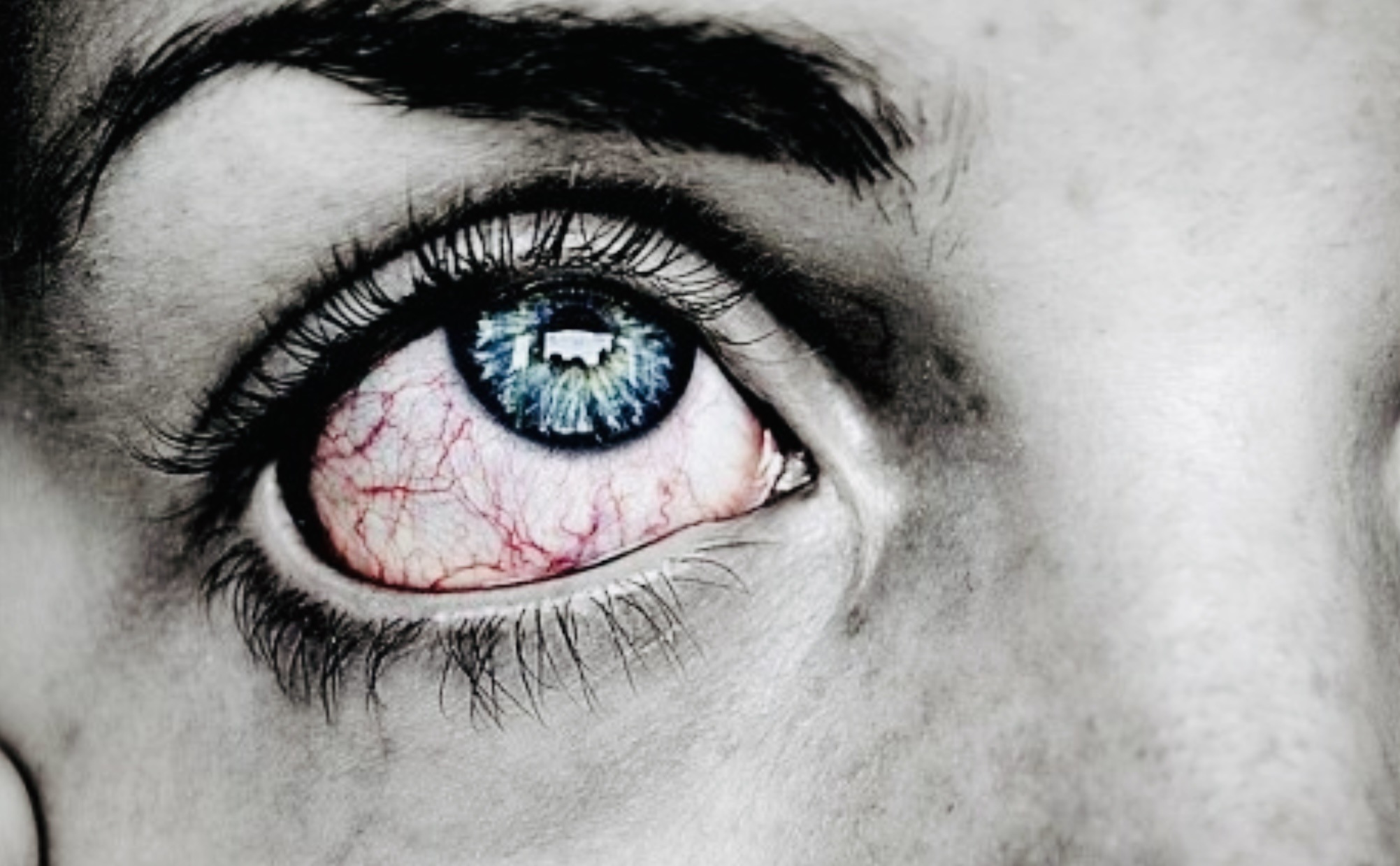 Waspadai Stroke Mata, Bisa Menyebabkan Kebutaan Akibat Sumbatan Darah ke Retina 