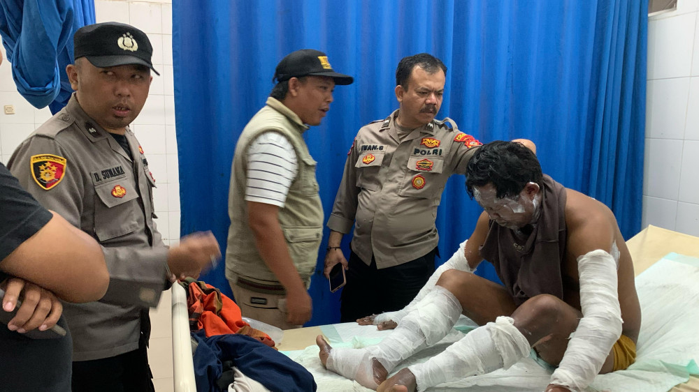 Pedagang Mi Tektek Kota Tasikmalaya Luka Bakar Akibat Letupan Gas LPG