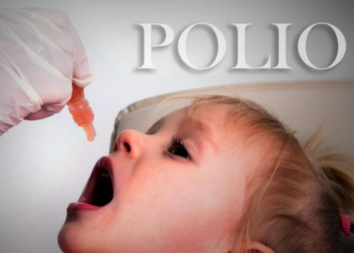 Kasus Anak Positif Polio Ditemukan di Kabupaten Purwakarta, Begini Ciri Anak Terkena Virus Polio