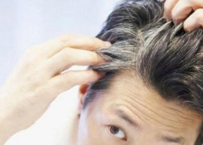 Shampo Penghilang Rambut Beruban di Indomaret Termurah Pilihan Terbaik untuk Rambut Hitam Berkilau