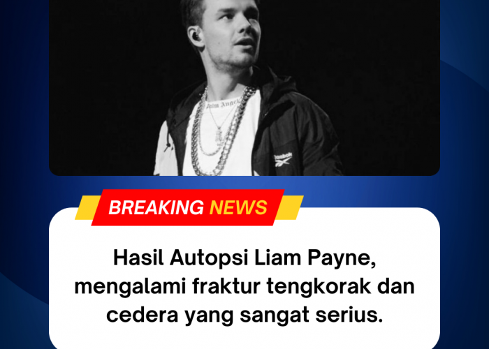 Hasil Autopsi Liam Payne dan Fakta di Balik Tragedi Kematian Eks Personel One Direction